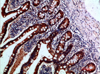 Rabbit Polyclonal Antibody to IL-37