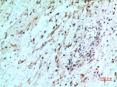 Rabbit Polyclonal Antibody to CXCR2