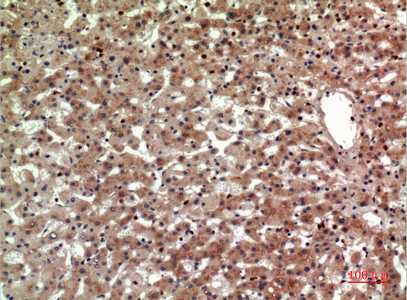 Rabbit Polyclonal Antibody to CRTH2