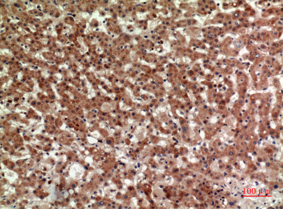 Rabbit Polyclonal Antibody to CRTH2