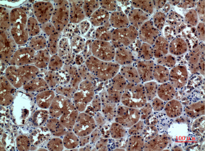 Rabbit Polyclonal Antibody to Neuropilin 1