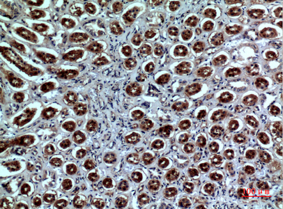 Rabbit Polyclonal Antibody to Neuropilin 1