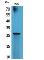 RNA Polymerase III Subunit C7