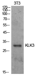 Prostate Specific Antigen
