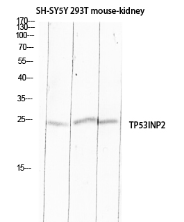 TP53INP2