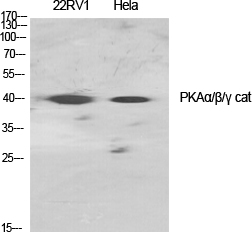 cAMP Protein Kinase Catalytic Subunit