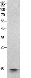Histone H2B