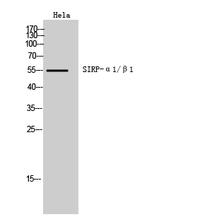 SIRP alpha/beta