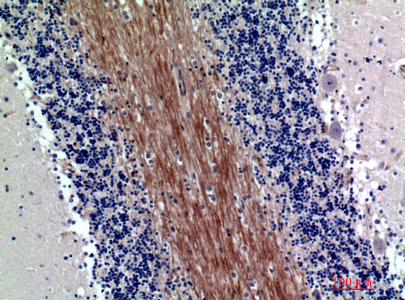 Rabbit Polyclonal Antibody to SIRP alpha/beta