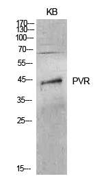 CD155