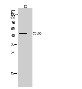 Rabbit Polyclonal Antibody to CD155