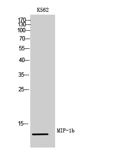 Rabbit Polyclonal Antibody to CCL4L