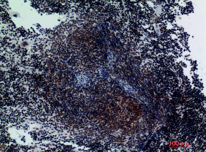 Rabbit Polyclonal Antibody to Integrin alpha 3