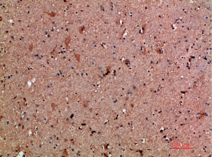 Rabbit Polyclonal Antibody to NNT1
