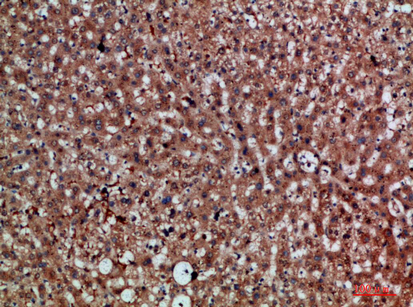 Rabbit Polyclonal Antibody to CDNF