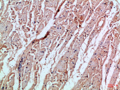 Rabbit Polyclonal Antibody to MIA