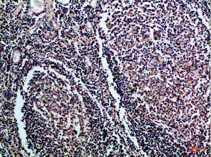 Rabbit Polyclonal Antibody to CD1a/b