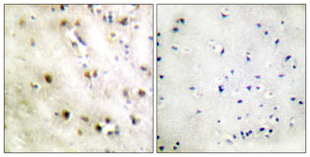Rabbit Polyclonal Antibody to ZFP36L1