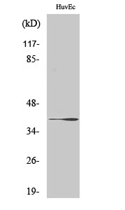 beta 3 Gal T1