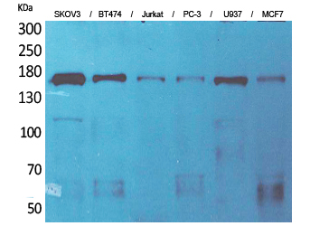 Synaptonemal Complex Protein 2