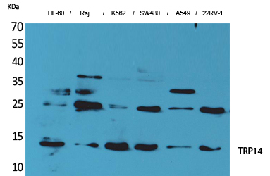 Thioredoxin Domain Containing Protein 17