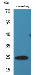 Endothelin 1