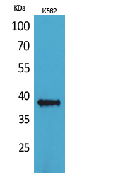 CD1C