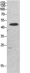 Elongation Factor 1A1/2/P5