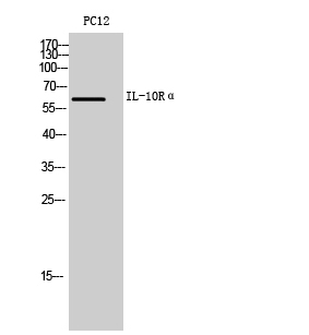 IL-10 Receptor alpha