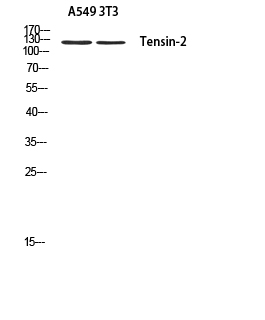 Tensin 2