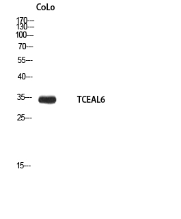 TCEAL6
