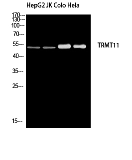TRMT11