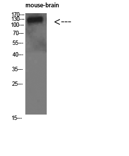 Collagen IV alpha 1