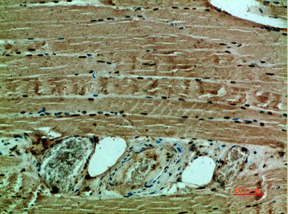 Collagen XII alpha 1