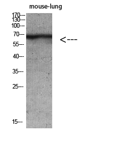 Cytokeratin