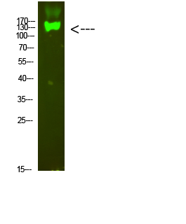 Integrin beta 7