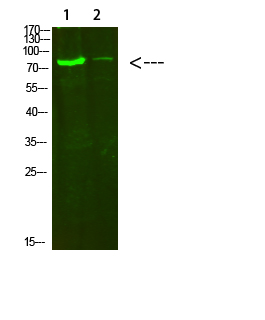 Collagen VIII alpha 2