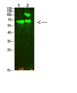 Collagen XIII alpha 1