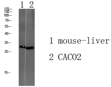 Transmembrane Protein 72