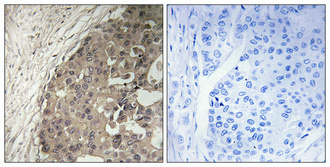 beta 4 GalNAcT1