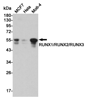 RUNX