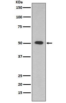 ALDH1A1