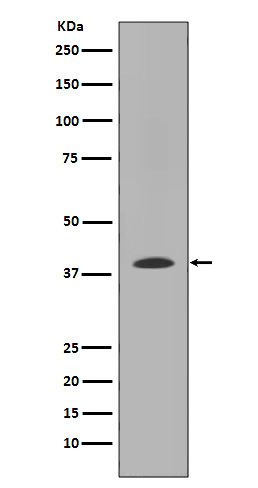 MMP12