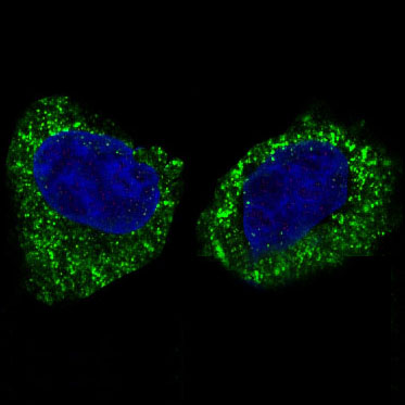 Rabbit Monoclonal Antibody to IKK beta 