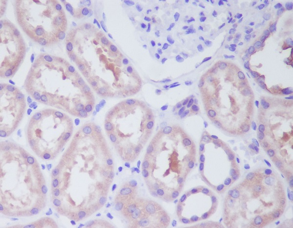 Rabbit Monoclonal Antibody to IKK beta 