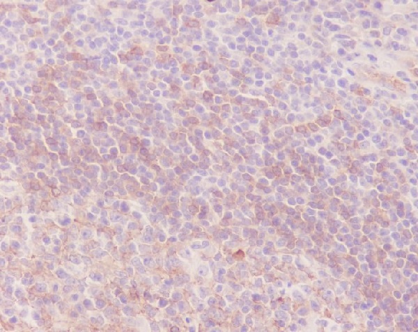 Rabbit Monoclonal Antibody to Human IgM 