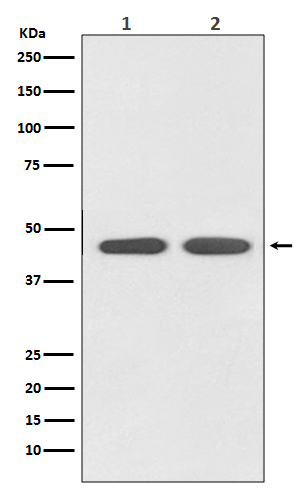 Angiotensin II Type 1 Receptor