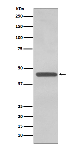 TDP 43