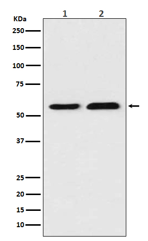 Thioredoxin Reductase 1