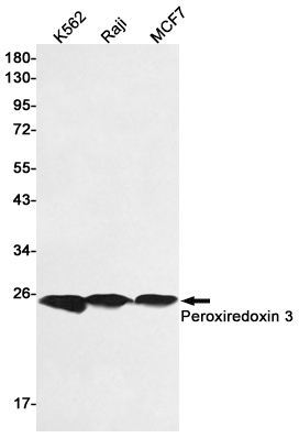 Peroxiredoxin 3